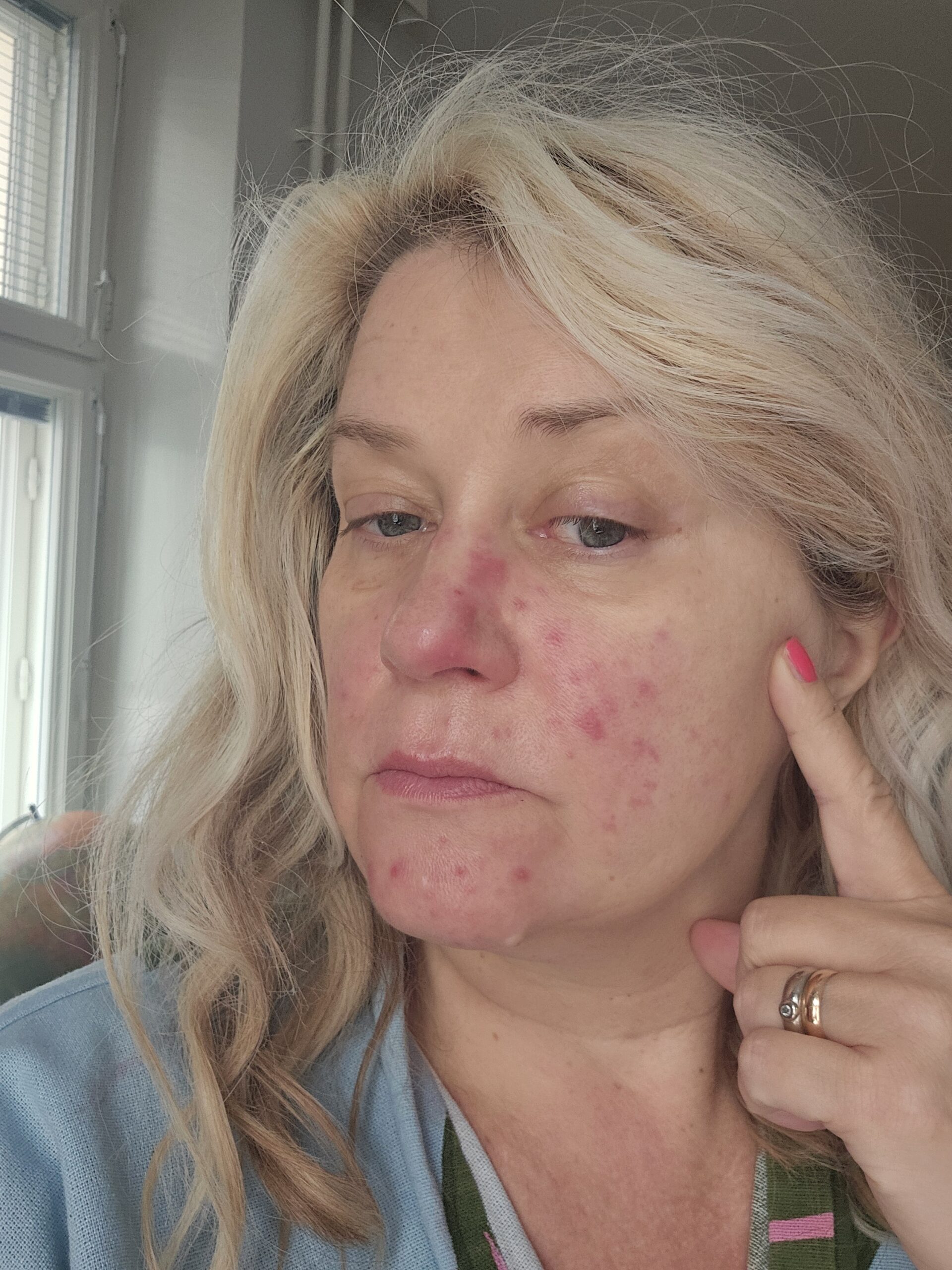 IhoPro hoiti ruusufinnin kuntoon!